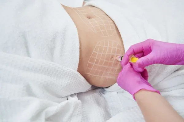 image of fat dissolving injections on love handles to help combat weight gain Stowmarket