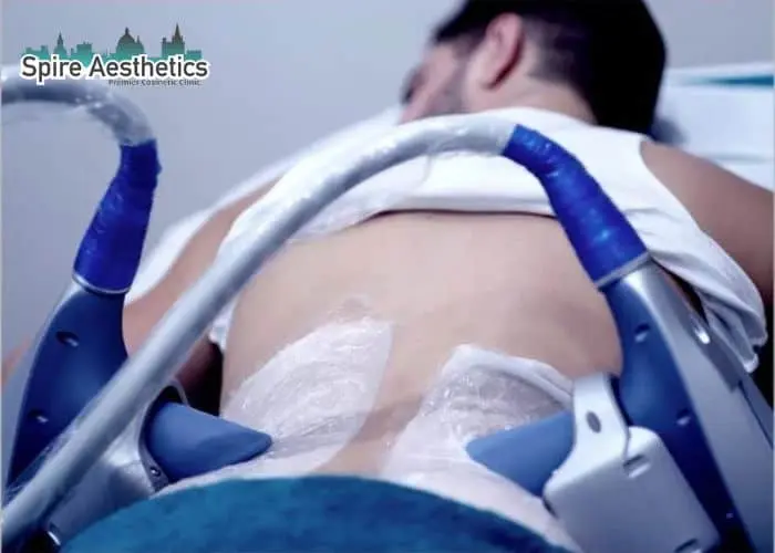 Man having fat freezing treatment done on love handles before a competitions Stowmarket to create a sculpted look.