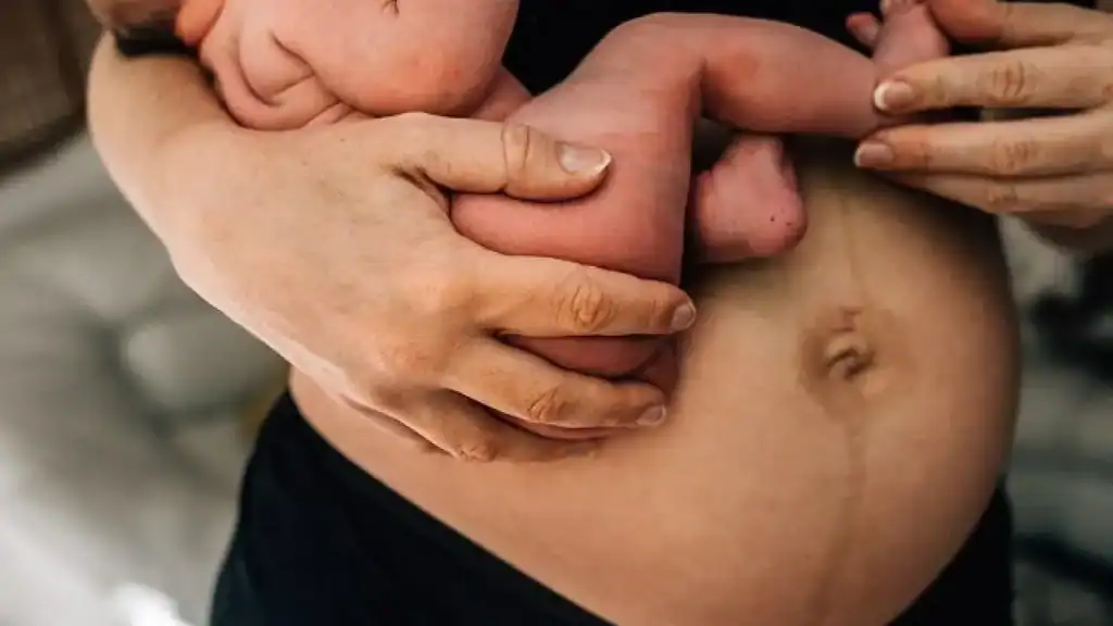 Why Is My Stomach Still Big After Pregnancy Stowmarket?